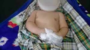 Seorang bayi perempuan berusia sembilan bulan meninggal dunia di bandar baru bangi setelah dipercayai didera oleh suami kepada pengasuhnya sendiri. Bayi 20bulan Maut Didera Remaja Orangkita