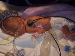 Fruhchen Leon 26 Ssw Youtube