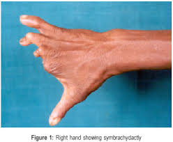 Vascular evaluation of the hand. Bioline International Official Site Site Up Dated Regularly
