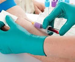 مرض السيدا ما الذي تعرفونه عنه ويب طب