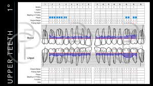 Periodontal Risk Assessment Pra In Clinical Case Reviews