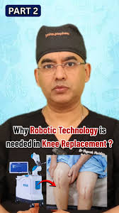 Why Robotic Technology is needed in Knee Replacement, Why is robotic  technology becoming so important in knee replacement surgery?, Globally,  studies showed that even after the best surgeries in top ...