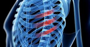 Image result for Chest Trauma