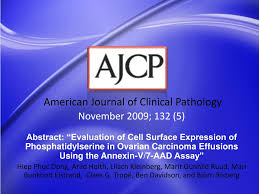 Ppt Abstract The Bethesda System For Reporting Thyroid Cytopathology Powerpoint Presentation Id 4128501