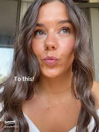 How I took my skin from this