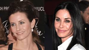 Plastic surgery procedures started as medical treatments but grew into cosmetic surgeries. Courteney Cox Explains Why She S Put The Kibosh On Plastic Surgery Someecards Celebrities