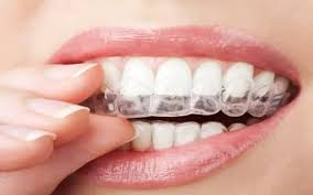 Férula de descarga: Beneficios