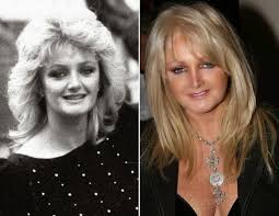 She first came to prominence in 1976 with the song, lost in france, which made the uk top 10. Bonnie Tyler Plastic Surgery