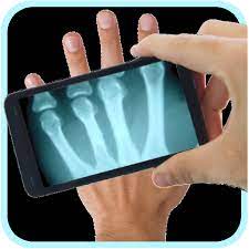 The app is quite plain as it functions as an xray clothes app that removes someone's clothes. Amazon Com Xray Scanner Apps Games