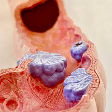 Arguably more than any other symptom, unexplained changes in the consistency, color, or movement of stool should raise concerns about colon cancer, particularly if the symptoms persist or worsen. 5 Colon Cancer Symptoms And Risk Factors Accelerated Urgent Care