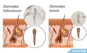 Image result for Demodex brevis