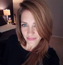 Embracing hair loss with confidence