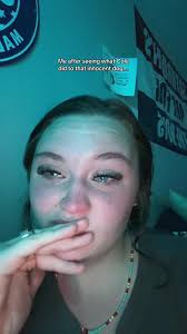 No dog should deserve that im in so much descust no one should deserve a  dog then put them through hell i have so much live for that dog and hes in  a better place and not with that horable owner that ...