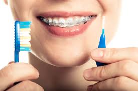 If you can get braces, free of cost to you, by one of the best dentist, why look anywhere else? Do I Qualify For Nhs Orthodontics Malmin Ortho