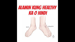 Pin On Dr Willy Ong
