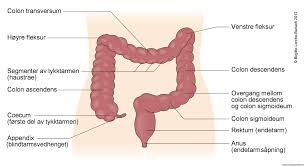 Miltpatologi, nyrepatologi, colontumor i venstre fleksur, myokardinfarkt. Tykktarmskreft Symptomer Og Tegn Nhi No