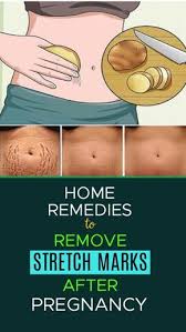 Pin On Stretch Mark Removal