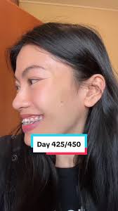 Closing Loop Orthodontics