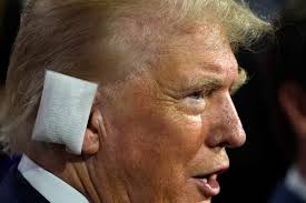 Trump Back Out in Public and Wearing a Massive Bandage Over Ear - Business  Insider