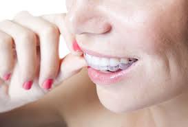 Here you may to know how to clean your invisible retainer. How To Clean And Care For Invisalign Retainers