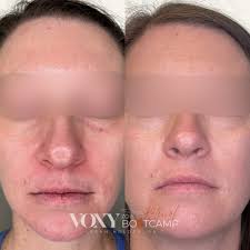 Leann Holder, PA-C (@leann_holderpa) • Mga litrato at video sa Instagram