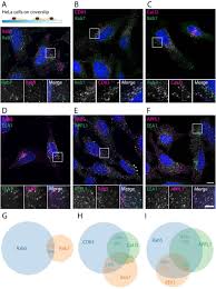 Check spelling or type a new query. Morpho Functional Characterization Of The Endo Lysosomal System By High Throughput Correlative Light Electron Microscopy Biorxiv