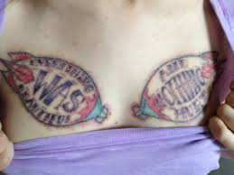 Before the advent of laser removal machines, people went to side effects: Laser Tatoo Removal Something To Get Off My Chest