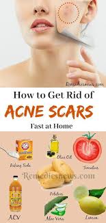 Pin On Beauty Tips Diy pin on beauty tips diy