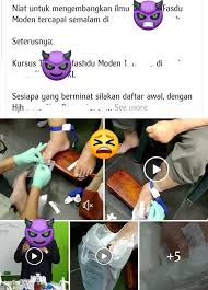 Hari ini saya akan berkongsi mengenai rawatan bekam yang kurang mendapat tempat dikalangan masyarakat. Klinik Avicenna Buang Darah Rawatan Untuk Gout 1 Bila Facebook