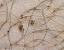 Scabies Pubic Lice
