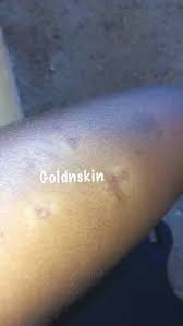 Pin On Dark Spot Corrector
