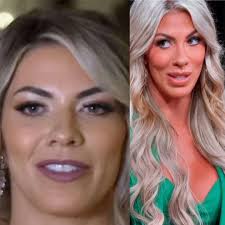 What work did Madison do to her face? : r/MarriedAtFirstSight