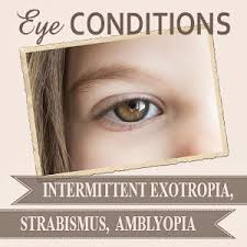 Intermittent Exotropia Considering Surgery Eye Exercises Vision Therapy Strabismus Surgery