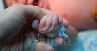 Kebiasaannya, penyebab demam kuning pada bayi dibahagi mengikut tempoh. Niat Jemur Elak Demam Kuning Bayi 7 Hari Putus Tangan Digigit Anjing Mingguan Wanita