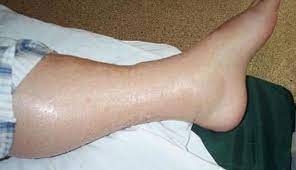 Pin On Compression Socks
