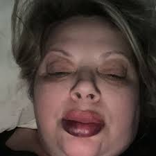 TOP 10 BEST Botox near Orange City, FL 32763