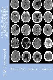 Image result for CT Head