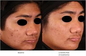 Skin Health and Disease: Vol 3, No 5