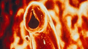 Image result for Hookworm