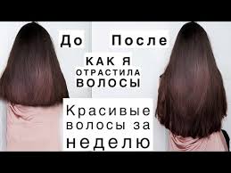 как отрастить волосы за 2 дня в домашних условиях Kak Otrastit Volosy Uhod Za Volosami V Domashnih Usloviyah Youtube
