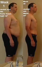 Gastric bypass before after pictures. 10 Mini Gastric Bypass Diet Plan Ideas Gastric Bypass Diet Gastric Bypass Diet