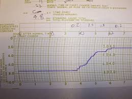 Rain Gauge Wikiwand