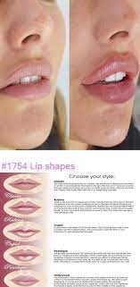 1754 Lip Shapes In 2021 Lip Fillers Dermal Fillers Lips Lush Lips