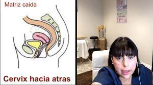 Porque Se Cae La Matriz Herbs And Holistic Care
