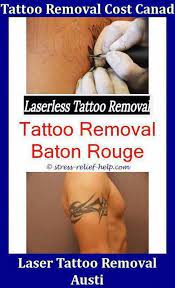 Best Way To Remove Tattoo At Home Tattoo Removal Chattanooga Skin Tattoo Removal How To Remove Permanen At Home Tattoo Removal Tattoo Removal Cost Laser Tattoo