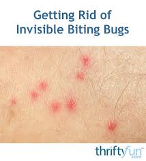 Getting Rid Of Invisible Biting Bugs Insect Bites And Stings Bites And Stings Insect Bites