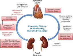 Maybe you would like to learn more about one of these? Fluid Volume Overload And Congestion In Heart Failure Circulation Heart Failure