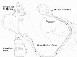 The patients o2 stat would determine his oxygen needs! Heated Humidified High Flow Therapy Wikipedia