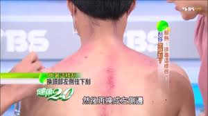 本來老婆都要我幫忙 手動方式刮痧 , 用手打換不同拔罐方式 只是會很累, 後來覺得. ä¸­æš' æŽ'æ¯'é€™æ¨£åš å°ˆå®¶æ•™ä½ åˆ®ç—§æ€Žéº¼åˆ® å¥åº·2 0 å®Œæ•´ç‰ˆ Youtube