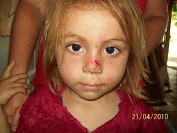 Personal de “BAYVIEW FINANCIAL” en supervisión y Apoyo en los proyectos de  Children´s Wellness Fund.